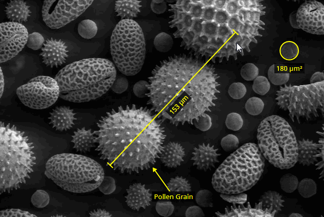 A React component for measuring & annotating images